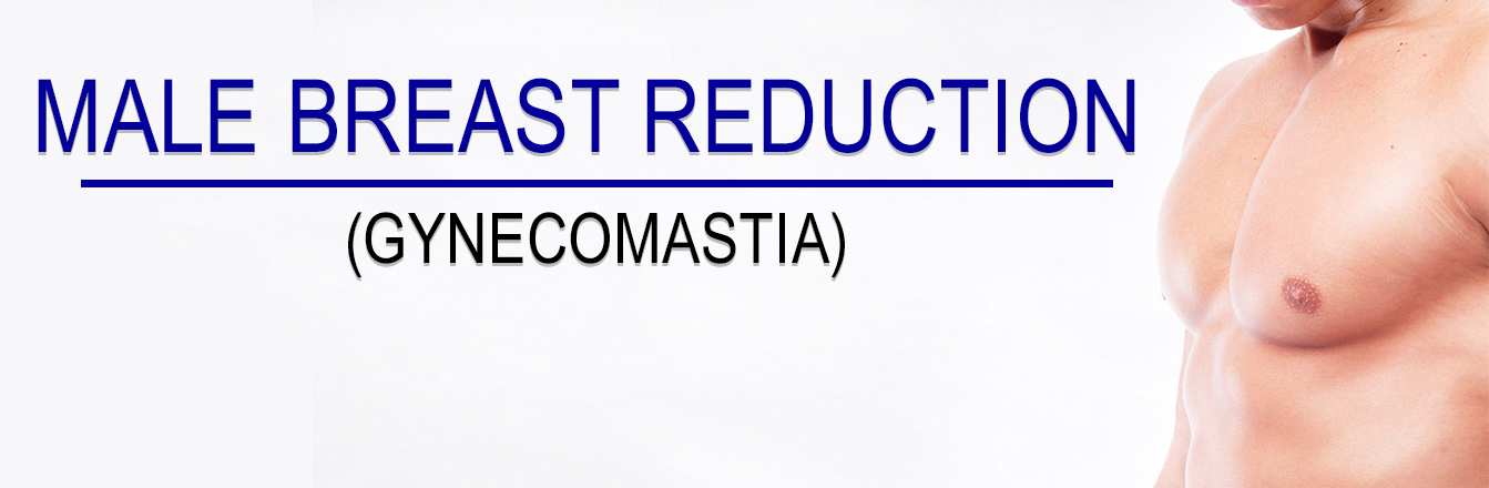 Male Breast Reduction in Udaipur (Gynecomastia)