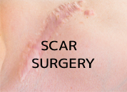 cosmetic surgery in Udaipur - scar surgery