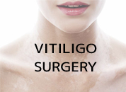 cosmetic surgery in Udaipur - vitiligo surgery