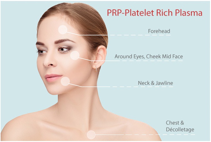 PRP Therapy For Face