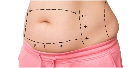 Body Sculpting Cosmetic Surgery in Udaipur