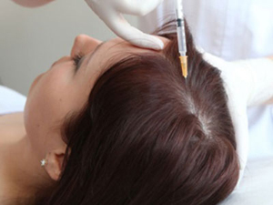 Mesotherapy Hair Treatment in Udaipur