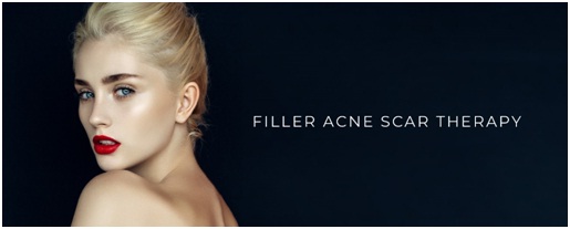 fillers for acne scar therapy