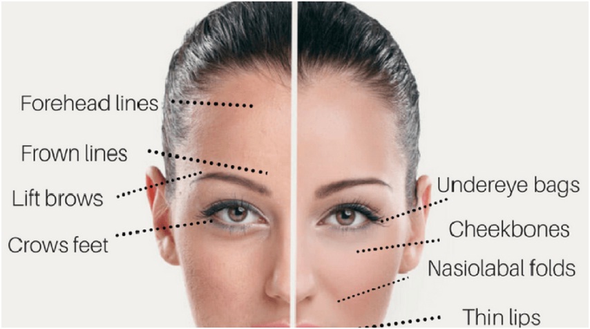 Botox Treatment in Udaipur