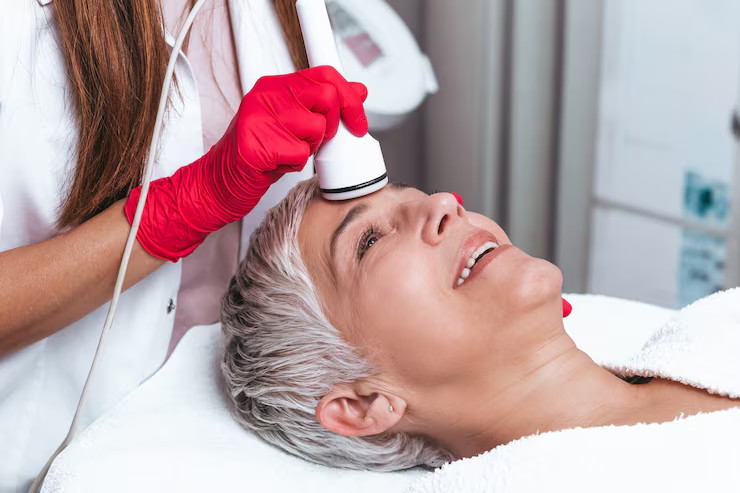 Anti-Ageing Laser Treatments