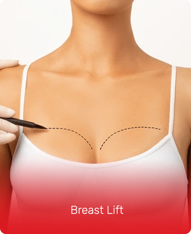 BREAST LIFT