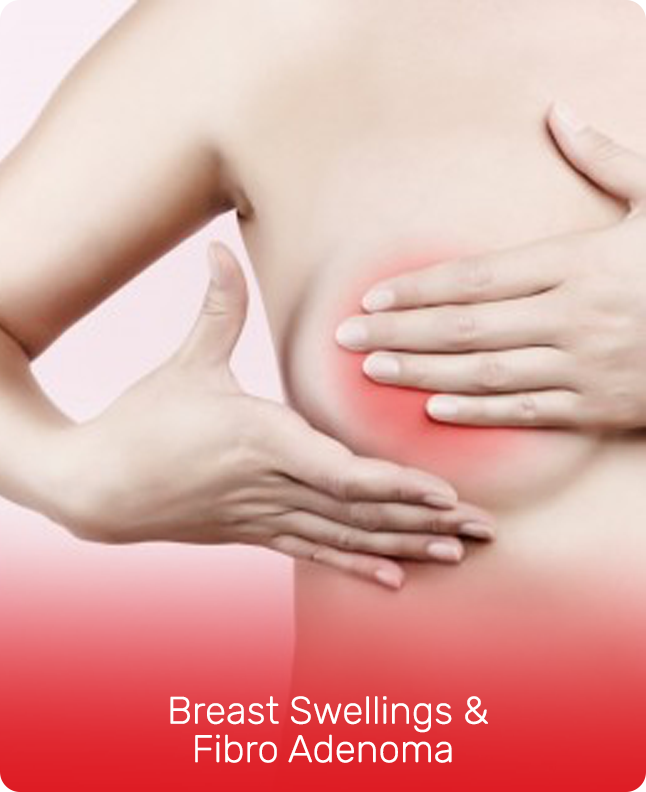 BREAST SWELLINGS & FIBRO ADENOMA