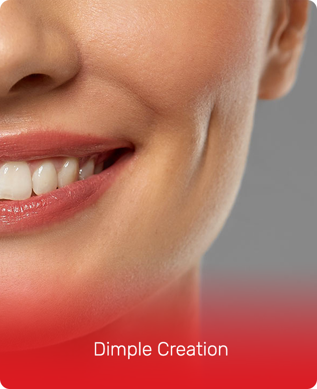 DIMPLE CREATION