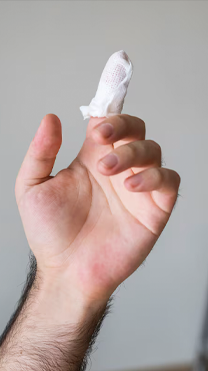 HAND AND FINGER INJURIES