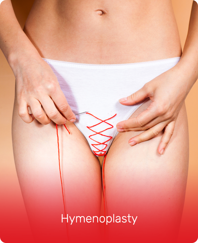 HYMENOPLASTY