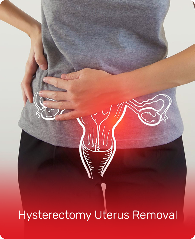 HYSTERECTOMY UTERUS REMOVAL