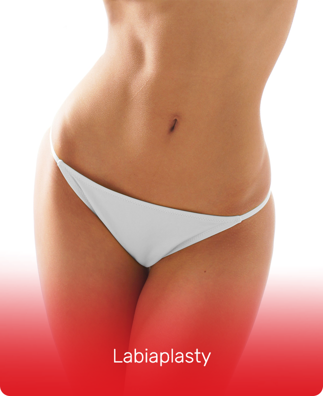 LABIAPLASTY