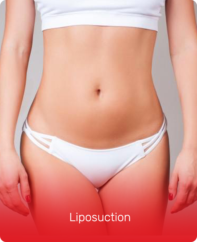 LIPOSUCTION