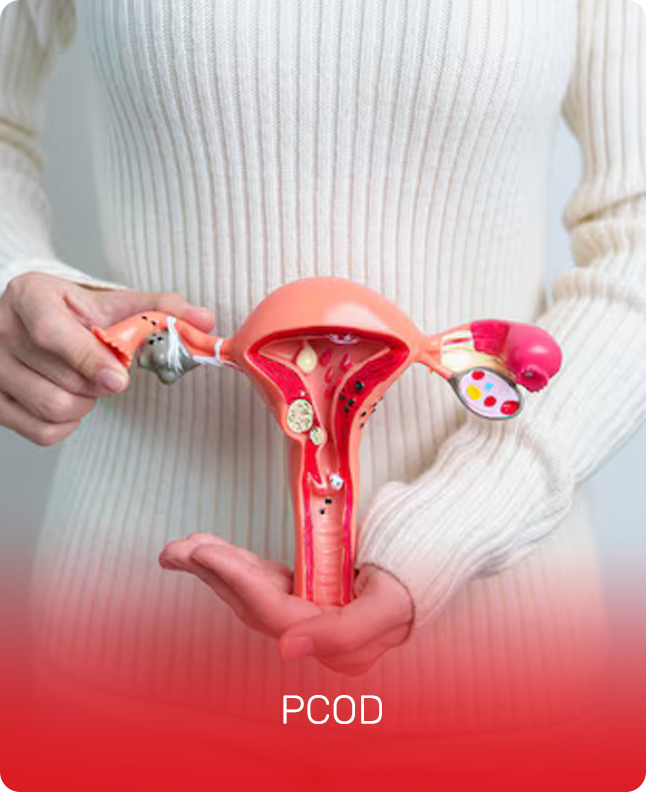 PCOD