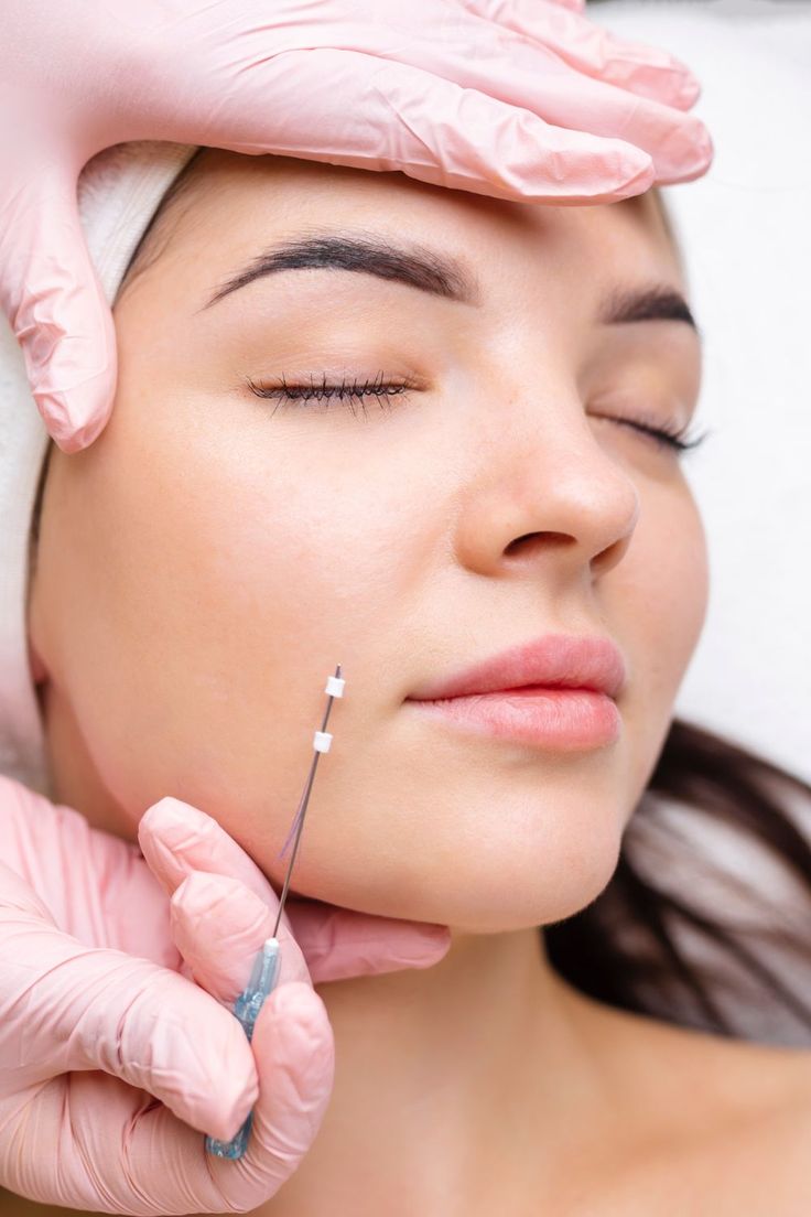 PDO Thread Lift Training_ A Skin-Lifting Technique