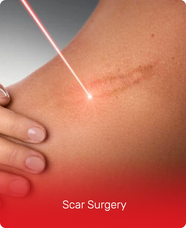 SCAR SURGERY