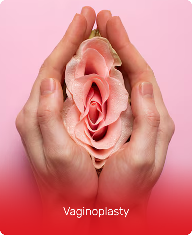 VAGINOPLASTY