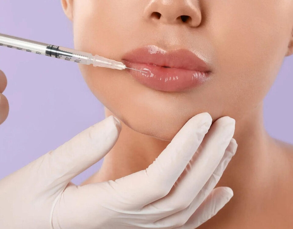 Demra Filler Treatment in Udaipur