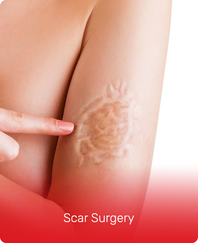 Scar Surgery (1)