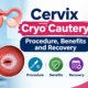 Cervix Cryo Cautery