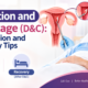 Dilatation and Curettage