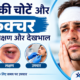 चेहरे की चोटें और फ्रैक्चर