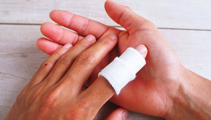What Are Hand and Finger Injuries?